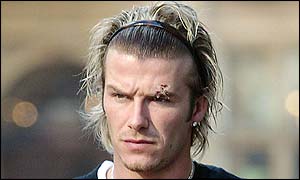 David Beckham's injury is clearly visible on Monday