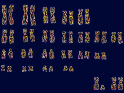 The 23 pairs of human chromosomes. People who inherit two tall X chromosomes (bottom right) are much more susceptible to autoimmune diseases than people with one X and one short Y chromosome.