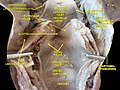 Disección profunda de la laringe, faringe y lengua vista desde atrás