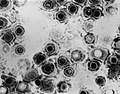 Thumbnail for Herpes simplex virus