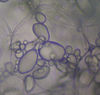 A potato cell containing amyloplasts.