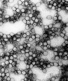 A TEM micrograph of the "Yellow fever virus"