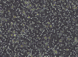 Hepatocytes in cell culture