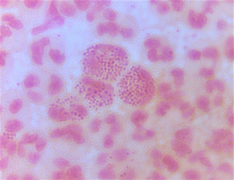 File:Gonococci in pus (Gram stain).jpg
