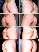 Male buttocks after erotic spanking