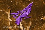 Thumbnail for Mycobacterium fortuitum