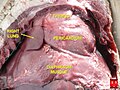 Thymus of a fetus