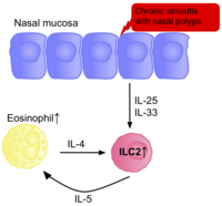 A diagram of the nasal mucosa,an ILC2 cell, and an eosinophil cell, with arrows displaying their interactions with one another, and how these interactions cause allergic rhinitis.
