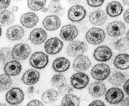 A HIV virionjainak elektronmikroszkópos képe