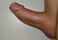 normal erect penis with slight upward curvature