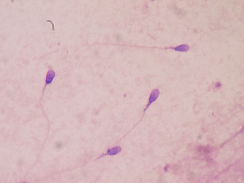 File:Sperm stained.JPG
