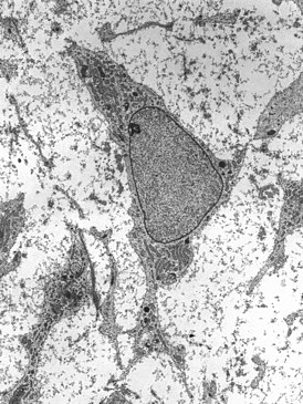 Просвечивающая электронная микрофотография мезенхимальной стволовой клетки, показывающая типичные ультраструктурные характеристики