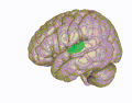 3D view of the transverse temporal gyrus in an average human brain