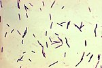 Thumbnail for Clostridium perfringens