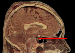 Hipofiza se nalazi s donje strane mozga