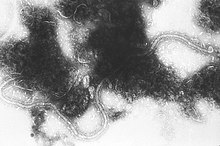 Transmission electron micrograph of "Human orthopneumovirus"