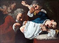 An operation in 1753, painted by Gaspare Traversi.