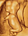 3D ultrasound of 3-inch (76 mm) fetus (about 14 weeks gestational age)