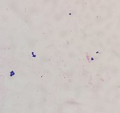 A few large, spherical, purple bacteria in small clusters on a faded pink background