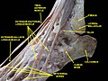 Ankle joint. Deep dissection. Lateral view *This has some structures labelled incorrectly e.g. tibialis anterior, extensor hallucis longus and cuboid bone