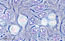 The photo depicts a culture of HeLa cells. They are stained in a light blue-purple color and seem to be in different phases of division. They look like abnormally shaped circles and are all squished in next to each other.