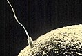 Bir spermatozon bir yumurta hücresini döllemek üzereyken.