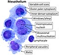 Cytology of the normal mesothelial cells that line the pericardium, with typical features.[13] Wright's stain.