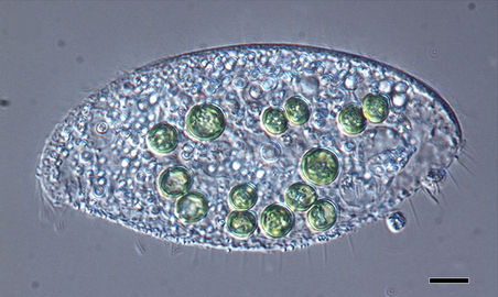 Species of Loxodes containing significantly large green-colored algae. Scale bar: 10 μm.[8]