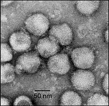 Electron micrograph of negatively stained NDiV virions