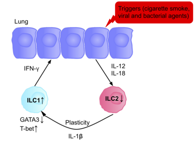 The lung epithelium after being triggered,by cigarette smoke, and the resulting effect this has on the ILCs in the microenvironment, in patients with COPD. This diagram displays the plasticity between the ILC2 and ILC1 cells in the presence of this trigger, and the cytokine IL-1B, causing an increase in the presence of ILC1, increasing the inflammation, and therefore contributing to the pathophysiology of the disease.