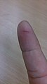 An incision: a small cut in a finger