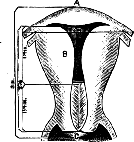 Цервикальный канал шейки матки заполнен цервикальной слизью, схематичное изображение фронтального среза