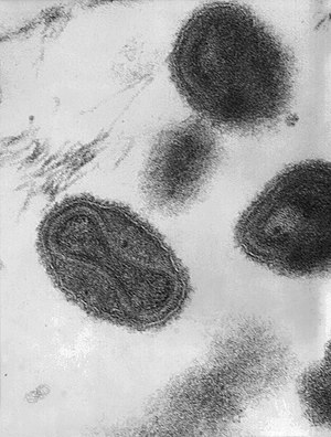 이 투과전자현미경 사진은 천연두 비리온(성숙한 바이러스 입자) 여러 개를 보여주고 있다. 비리온 속의 아령 모양 구조가 바이러스의 DNA를 품고 있는 바이러스핵이다. 배율: 370,000배 확대.