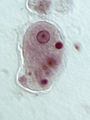 Entamoeba histolytica (영양체)