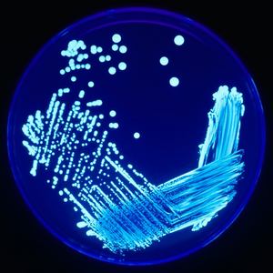 UV 조명 아래 비춰진 Legionella sp.
