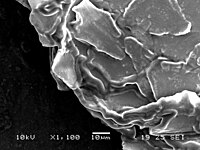 ヒトの頭垢、走査型顕微鏡画像