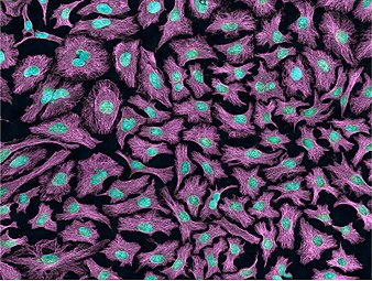Multiphoton fluorescence image of HeLa cells with cytoskeletal microtubules (magenta) and DNA (cyan). Nikon RTS2000MP custom laser scanning microscope.
