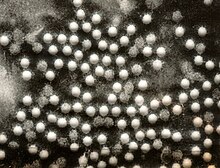 Electronmicrograph of "Poliovirus"