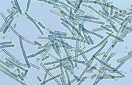 Microscope image of Cylindrospermum, a filamentous genus of cyanobacteria