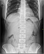 Medical X-Ray imaging IDP05 nevit.jpg