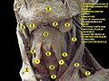 Larynx. Deep dissection. Anterior view.