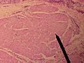 성대근의 단면을 현미경으로 본 사진
