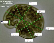 Measurements of a large Colpoda at 400x.