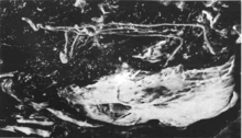 a large parasitic worm in the placenta of a whale, black and white photo