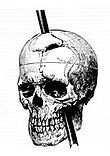 A diagram of the iron rod traveling through Gage's skull