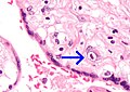 Close-up of Field #1 - shows the characteristic nucleus