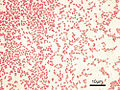 Thumbnail for Gram-negative bacteria
