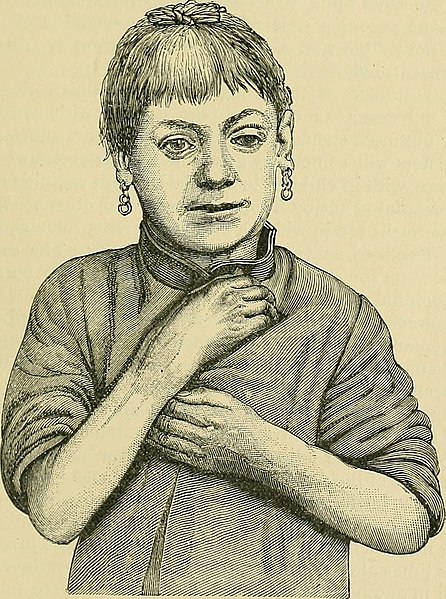 File:The diseases of children - medical and surgical (1900) (14804066153).jpg