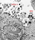 Thumbnail for Human T-lymphotropic virus 1