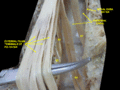 Spinal cord. Spinal membranes and nerve roots. Deep dissection. Posterior view.